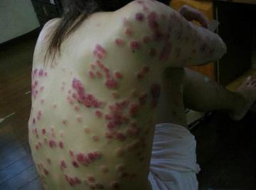 艾滋病最新新闻，自然美景中探寻生命勇气与内心平静之路