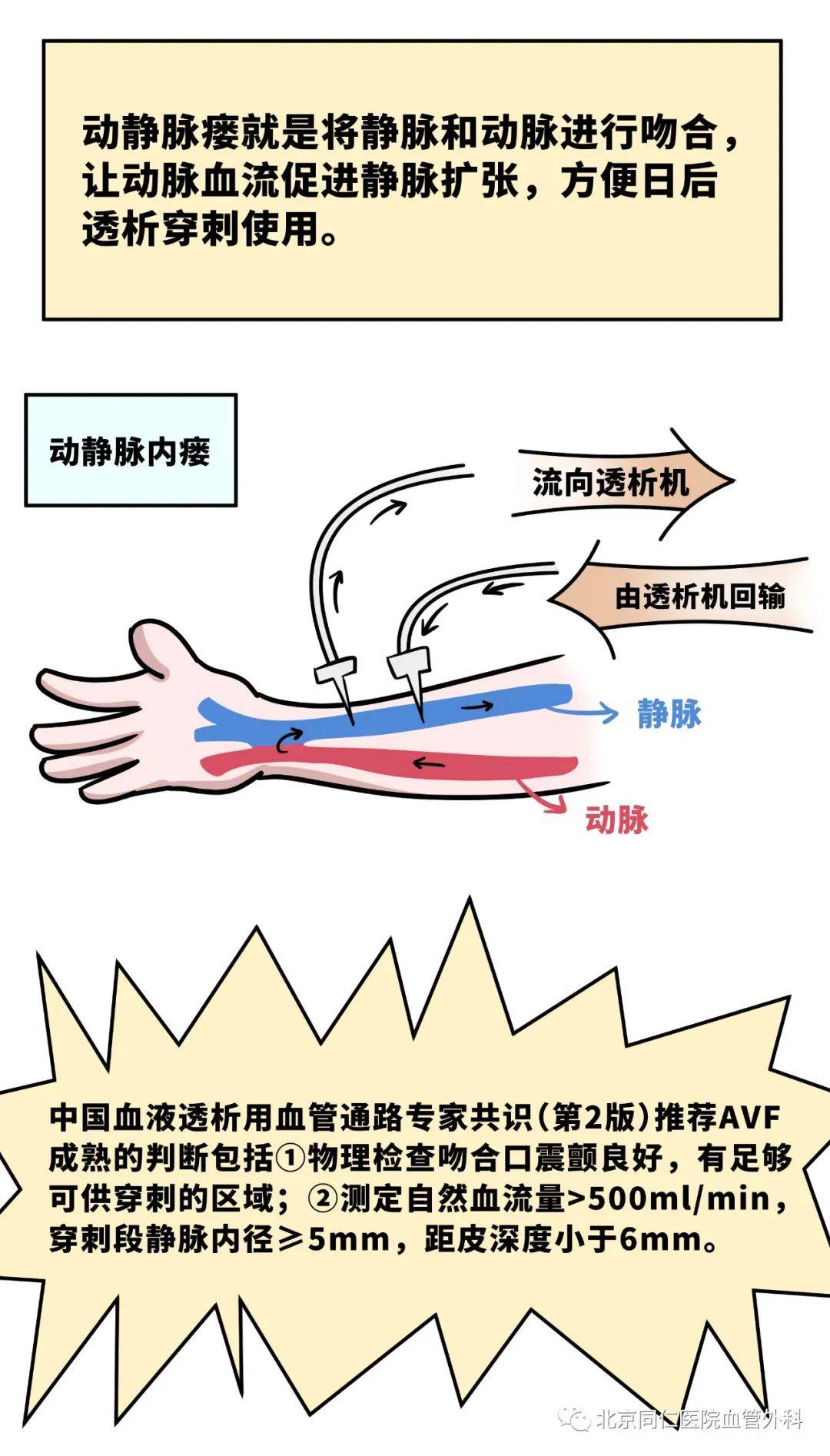 静脉瘘最新，友情与陪伴的温馨旅程之旅